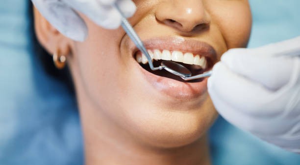 Best Emergency Dental Services for Seniors in East Pasadena, CA
